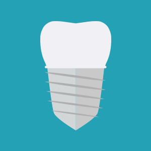 implante-mariano-odontologia-dentista-criciuma